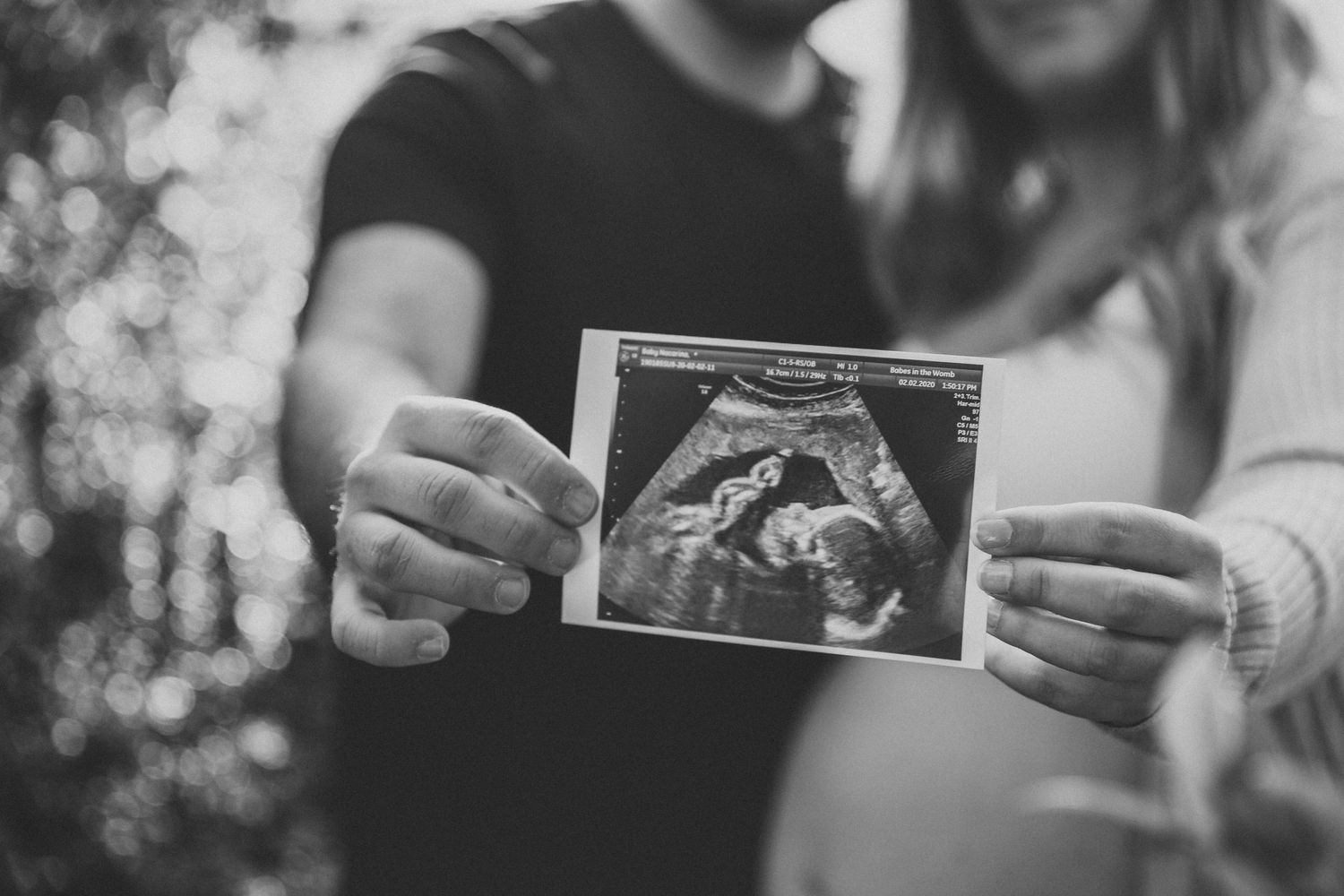 Edinburgh maternity photographer, pregnancy photoshoot at Botanic Garden, Edinburgh UK