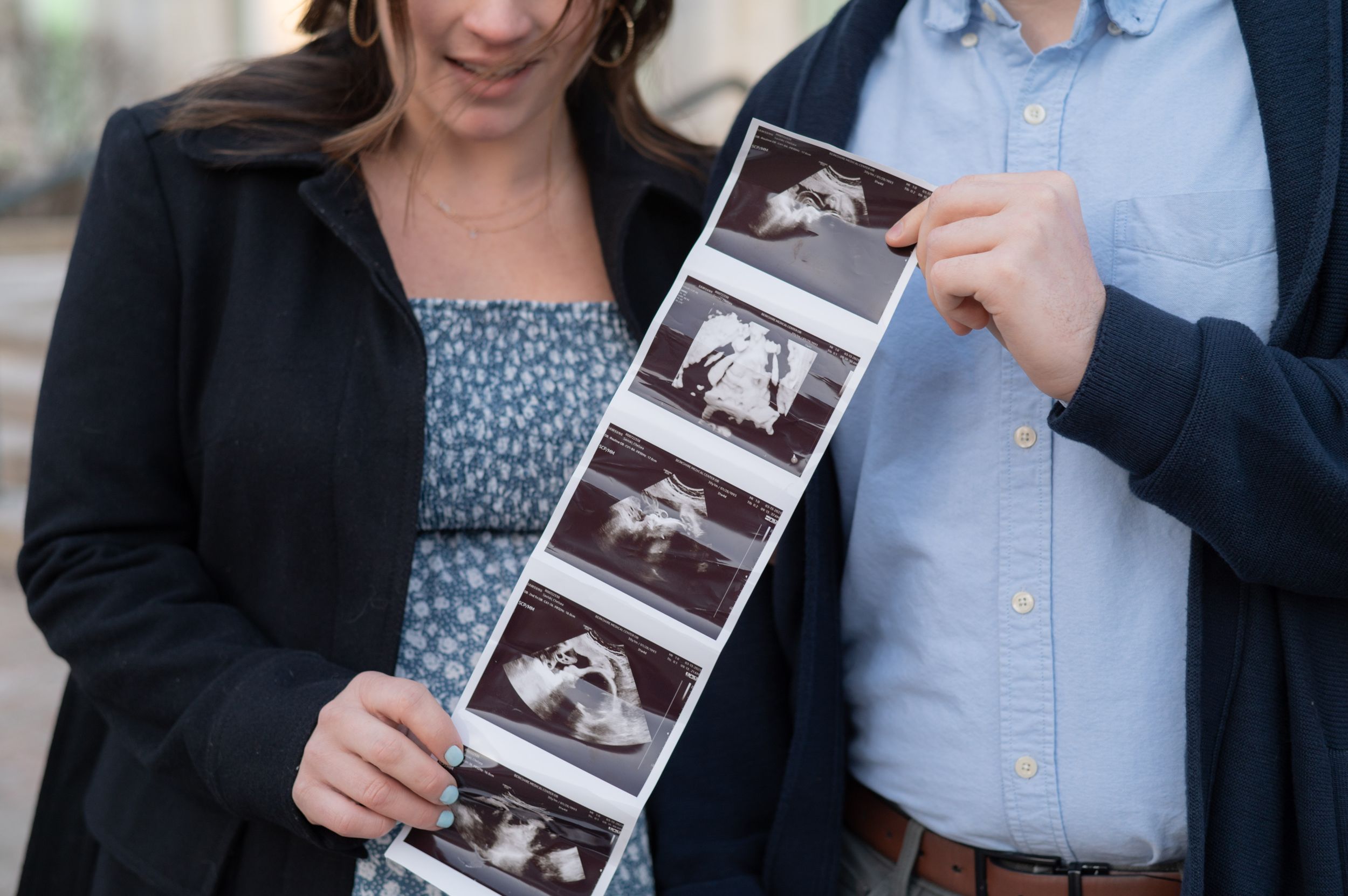 Couple holding ultrasound photos together outdoors.