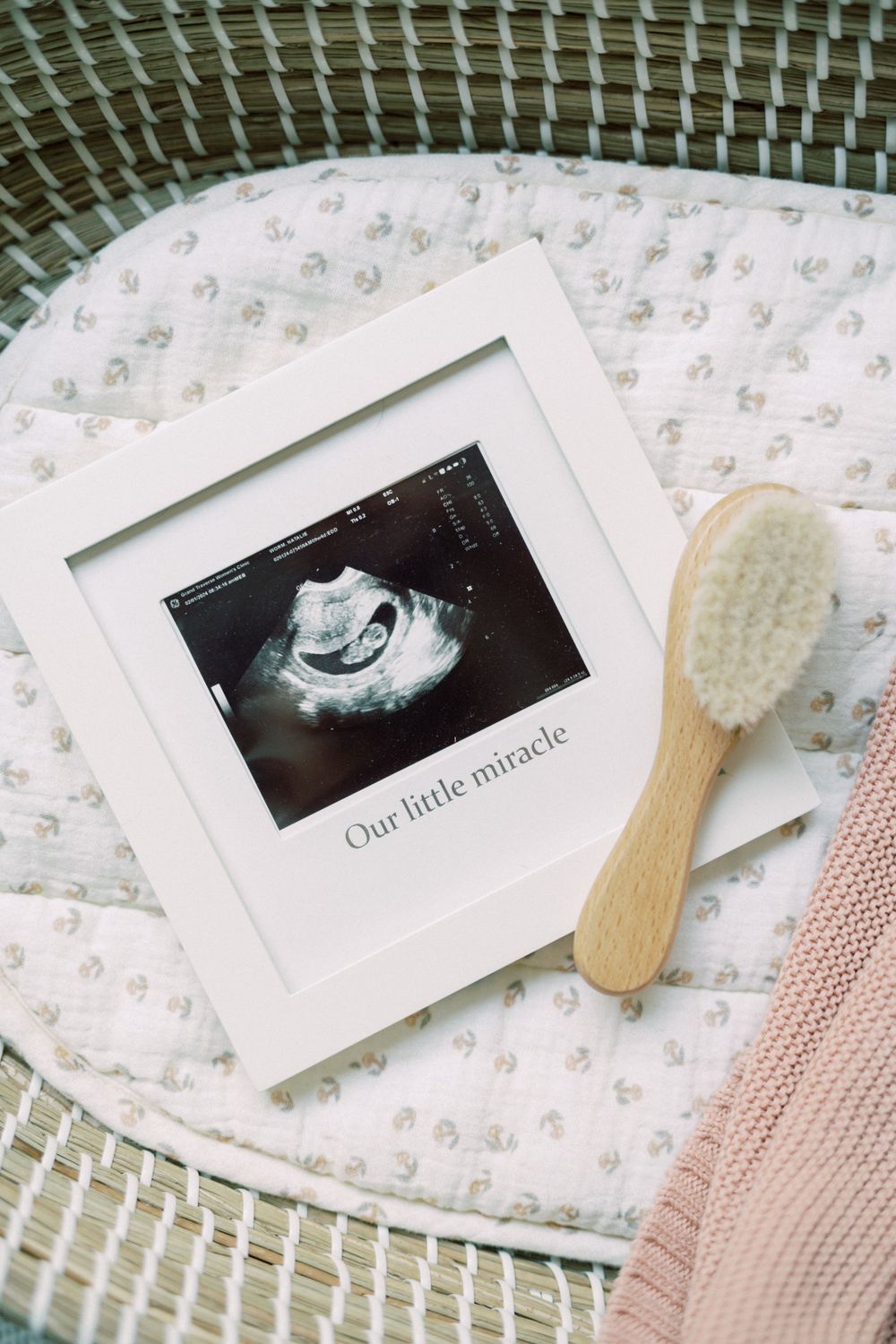Ultrasound photo framed with 'Our little miracle' text displayed on patterned fabric with wooden brush.