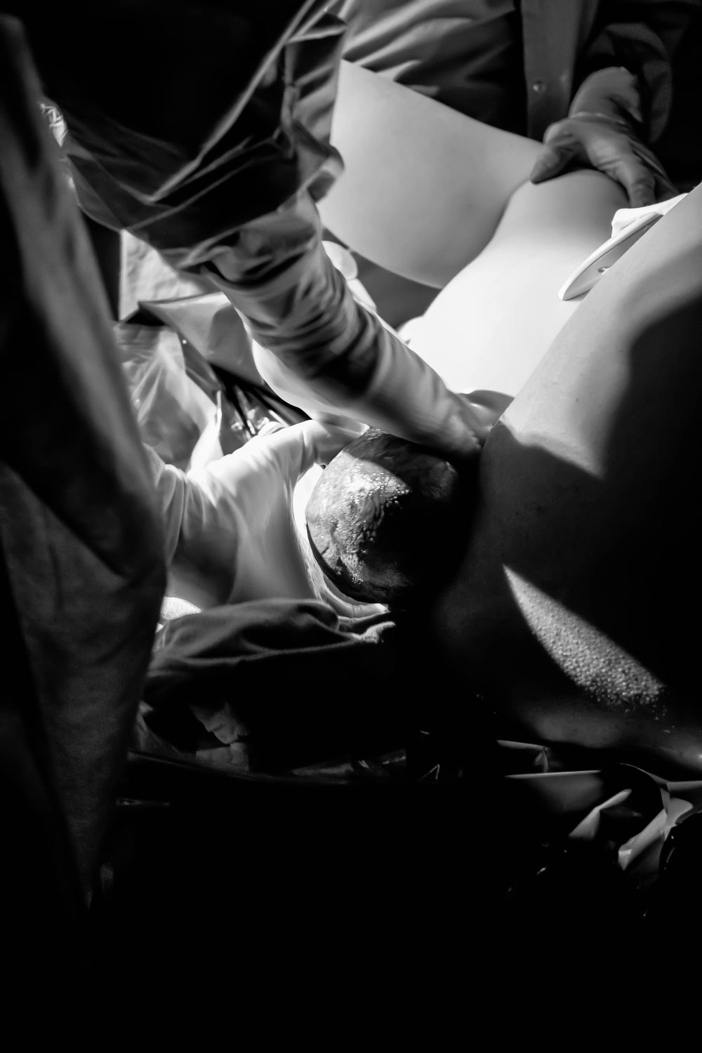 Black and white medical photo showing doctors catching a baby being born.