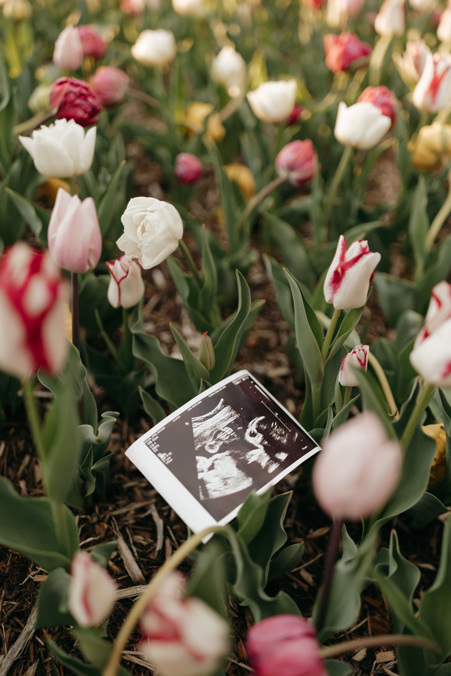 An ultrasound photo nestled among blooming pink and white tulips in a garden during spring.