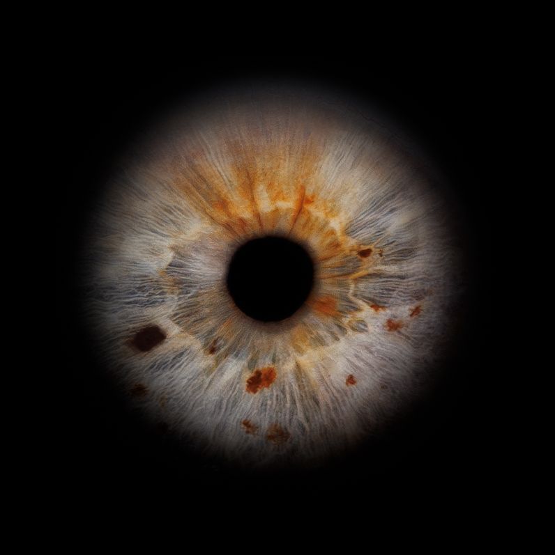 A sequence of brown iris close-up photographs showing extreme detail of the unique patterns and textures.