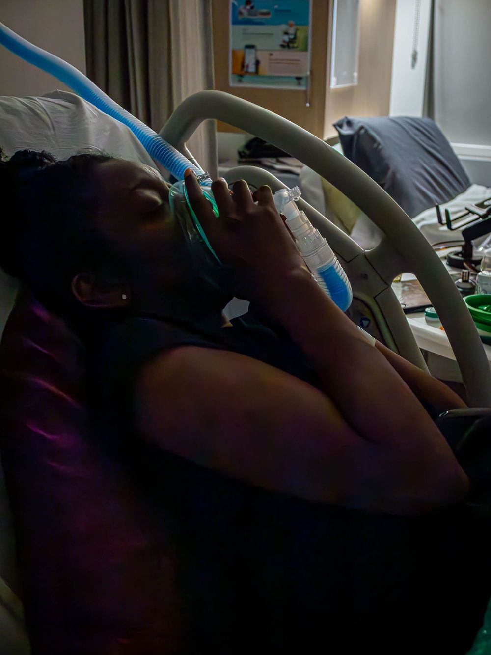 Patient receiving nitrous gas through a mask in a hospital bed during labor and delivery.