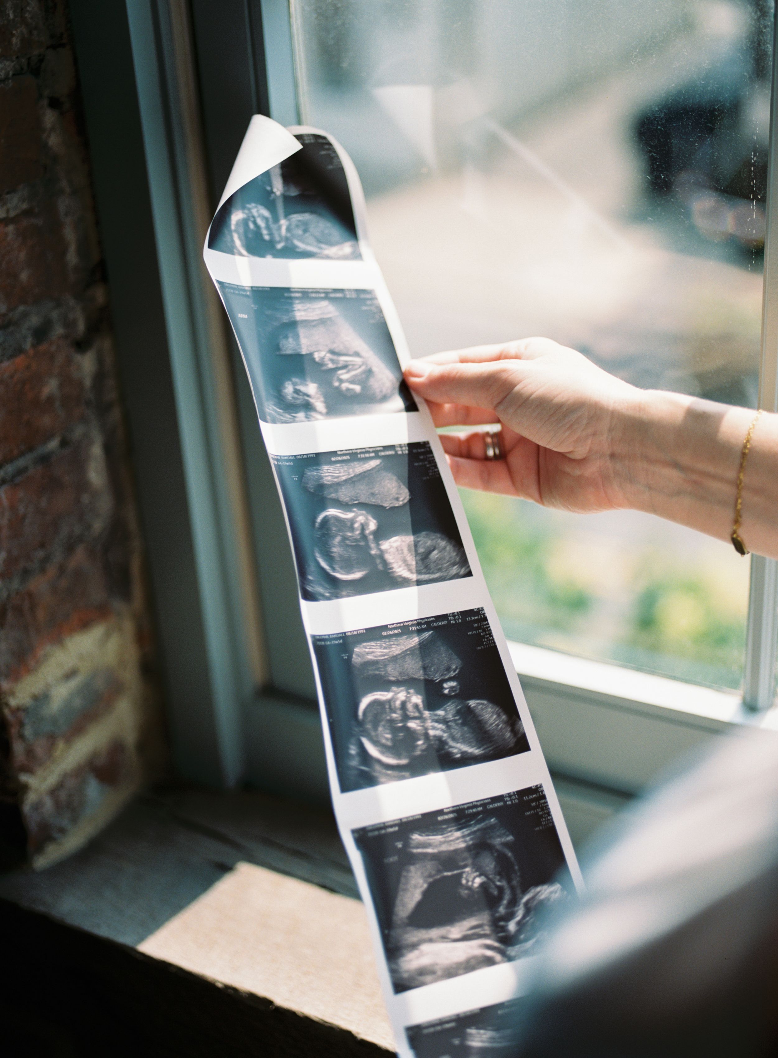 A hand holds up a strip of ultrasound images against a window showing the progress of a developing baby.