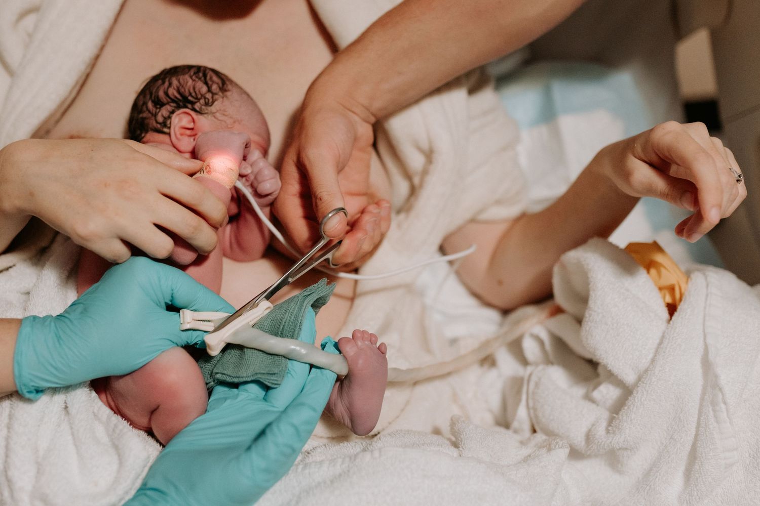 Medical staff wearing blue gloves performs first medical care examination on newborn baby while lying on white sheets.