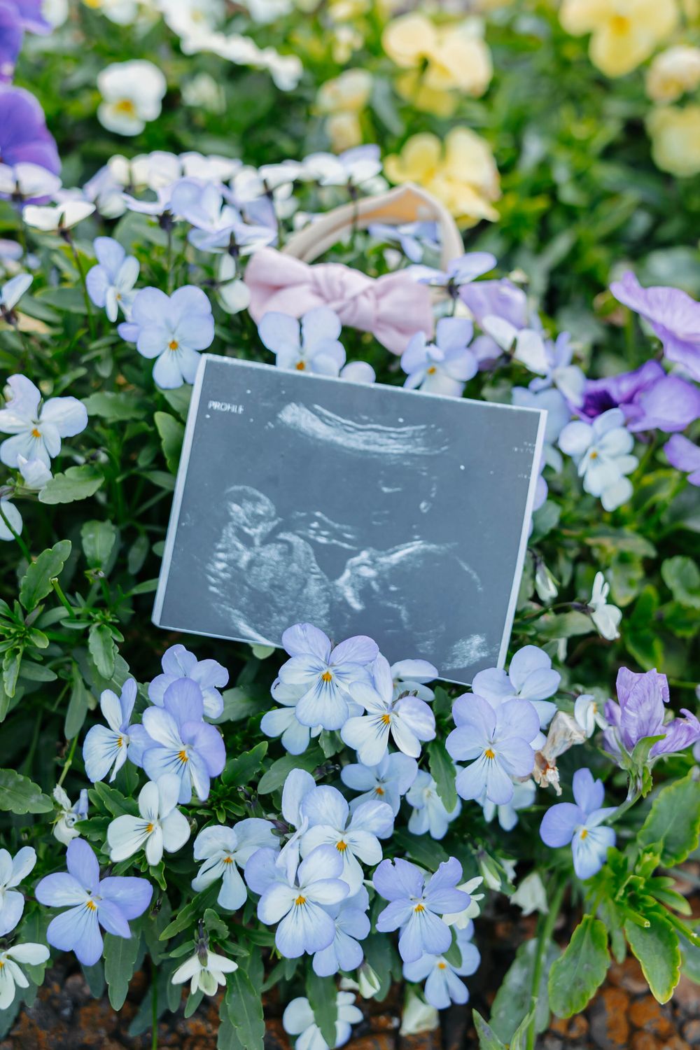 Centennial Park Maternity Session. Nashville, Tennessee Wedding Photographer