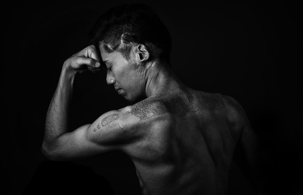 Black and white artistic portrait showing muscular and scarred back and shoulders in dramatic lighting.