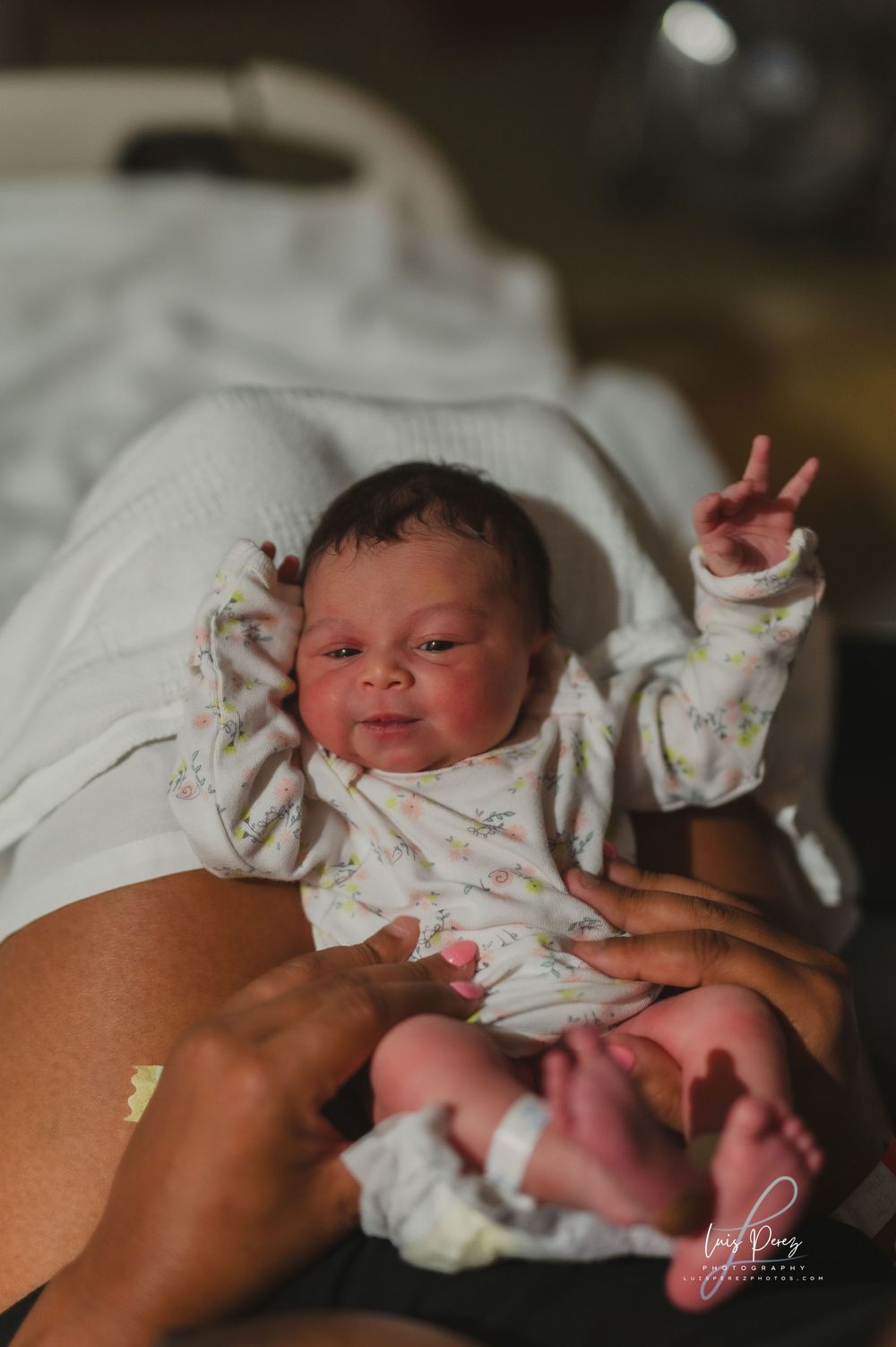 Newborn baby resting on white hospital bedding shortly after birth with monitoring wires visible.