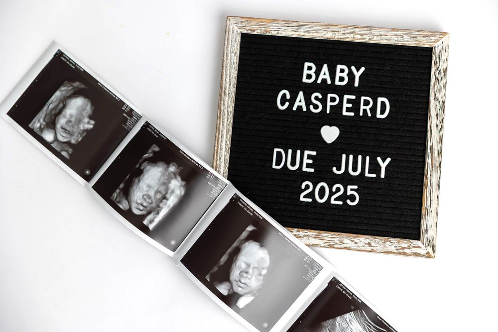 Black letter board pregnancy announcement with ultrasound photos displays Baby Casper due July 2025.