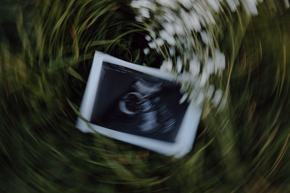 Artistic spinning motion blur of ultrasound photo against green background.