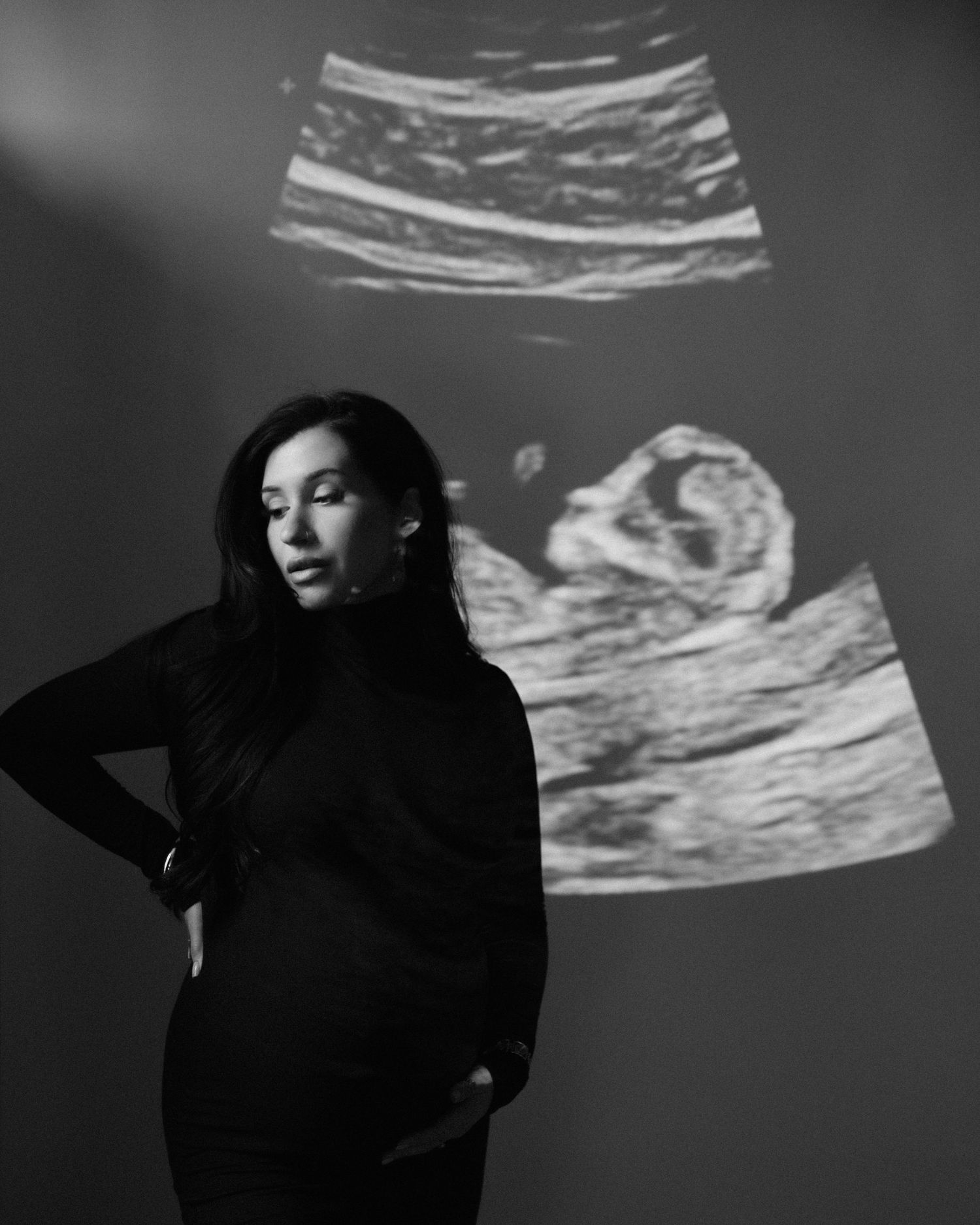 Black and white artistic portrait with ultrasound scans projected on wall showing pregnancy journey.
