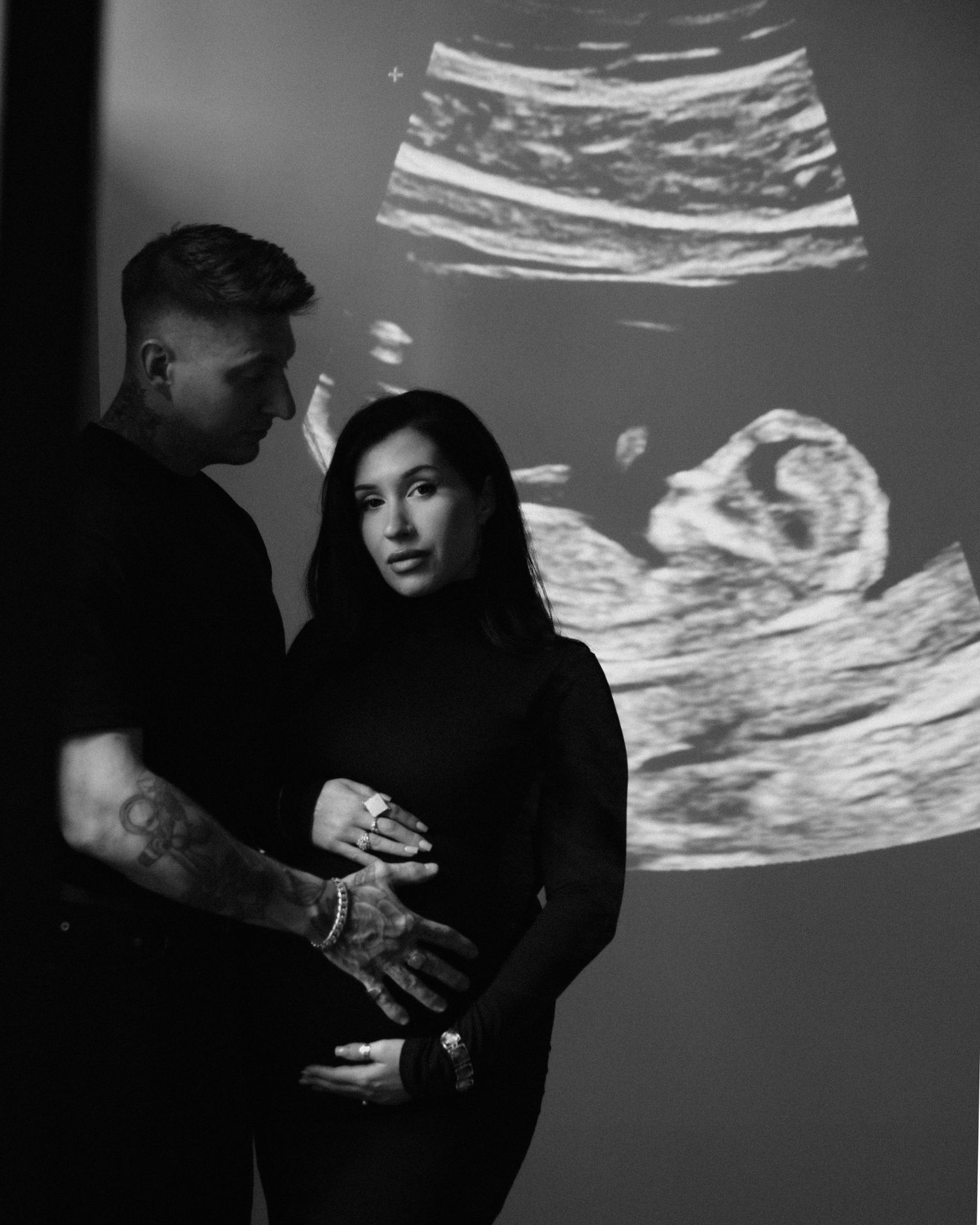 Black and white photo of a couple in silhouette with ultrasound images projected on wall showing a baby scan.