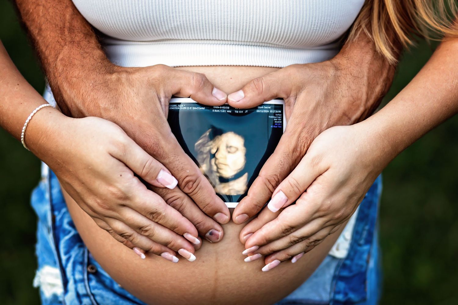Creative pregnancy photo with ultrasound image held against baby bump.
