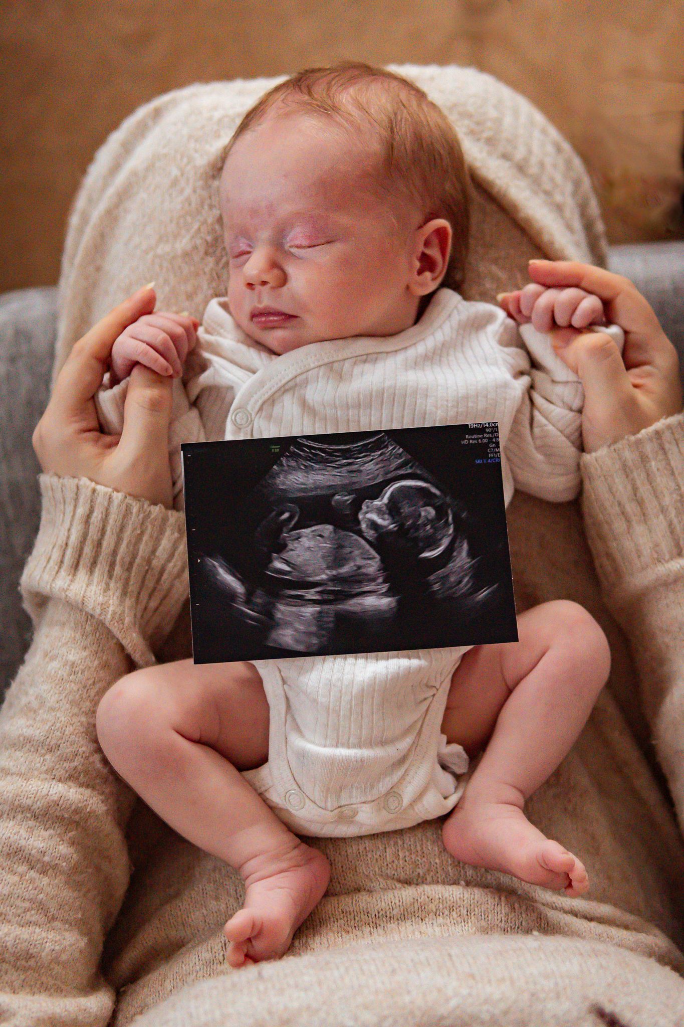 Sovande nyfödd bebis i vit body ligger i mammas knä med ultraljudsbild på magen och håller i mammas händer. Fotograf, nyföddfotograf, Umeå