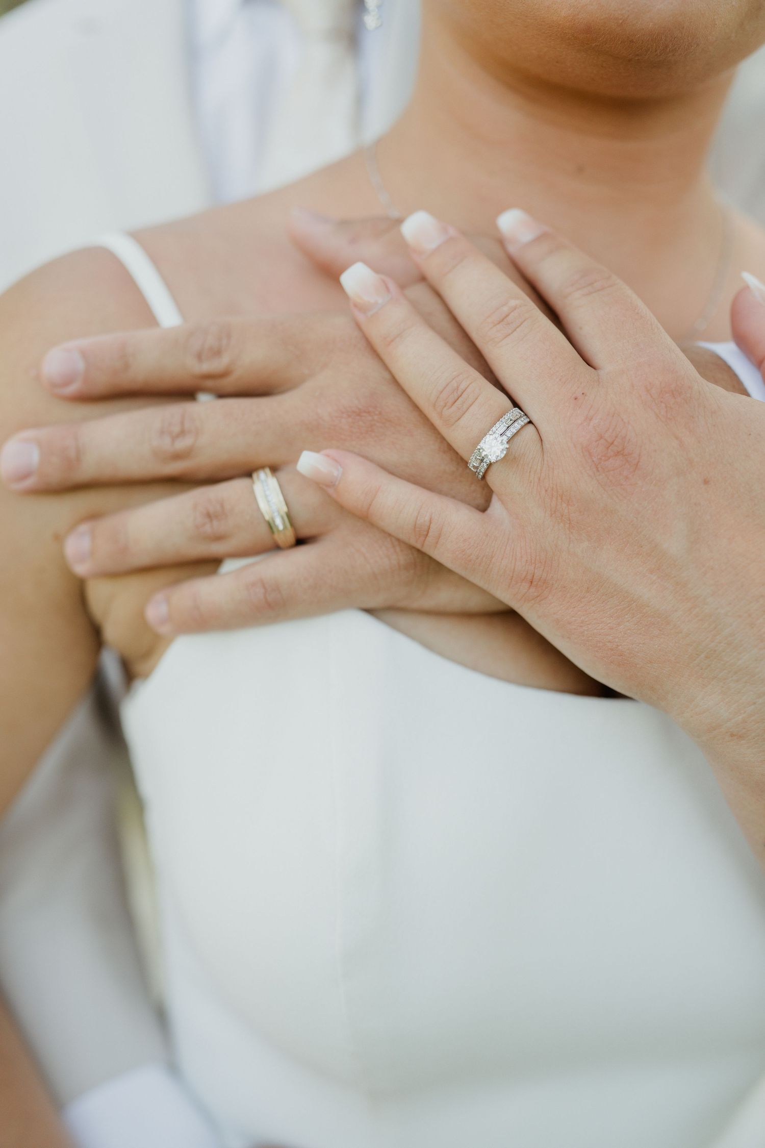 Close-up of two hands with wedding rings resting on white fabric.