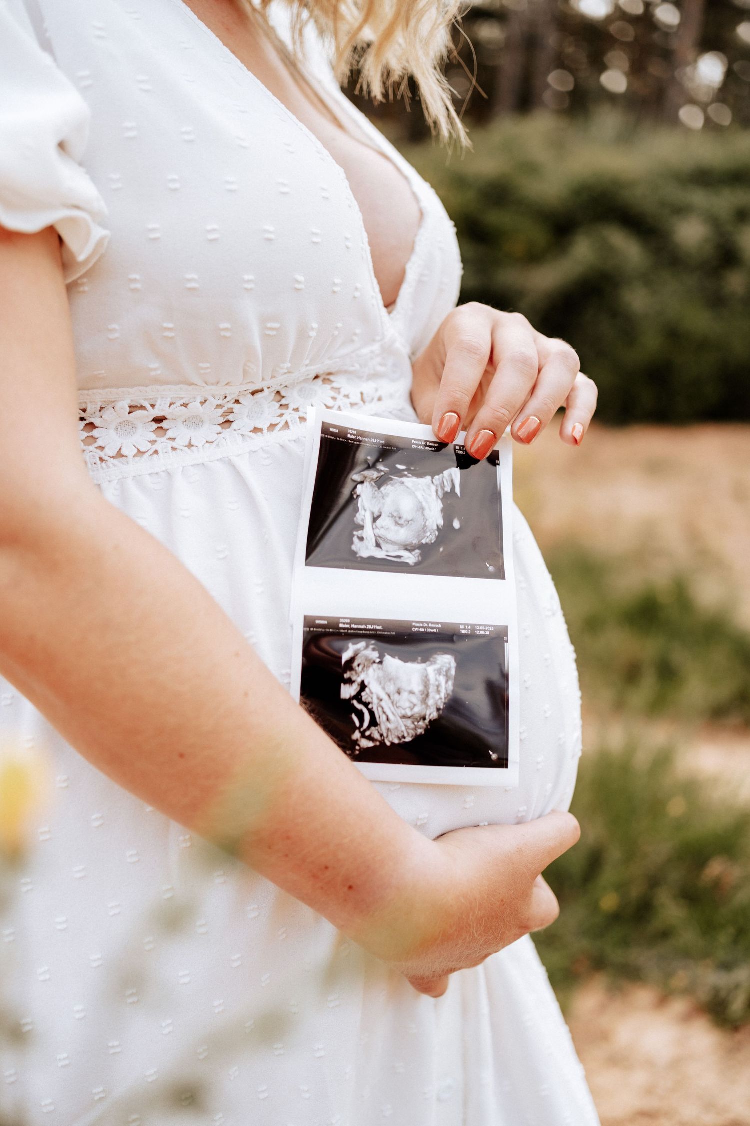 Schwangere Frau hält stolz Ultraschallbilder vor ihren Babybauch - Outdoor-Fotoshooting im Sommer.