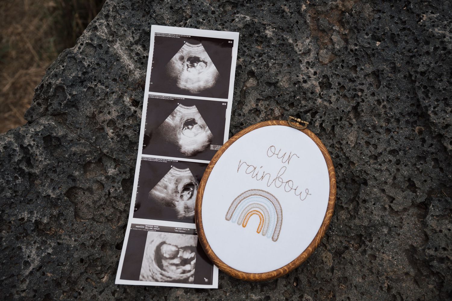 Ultrasound images displayed next to an embroidery hoop with a rainbow design and text on a dark stone surface.