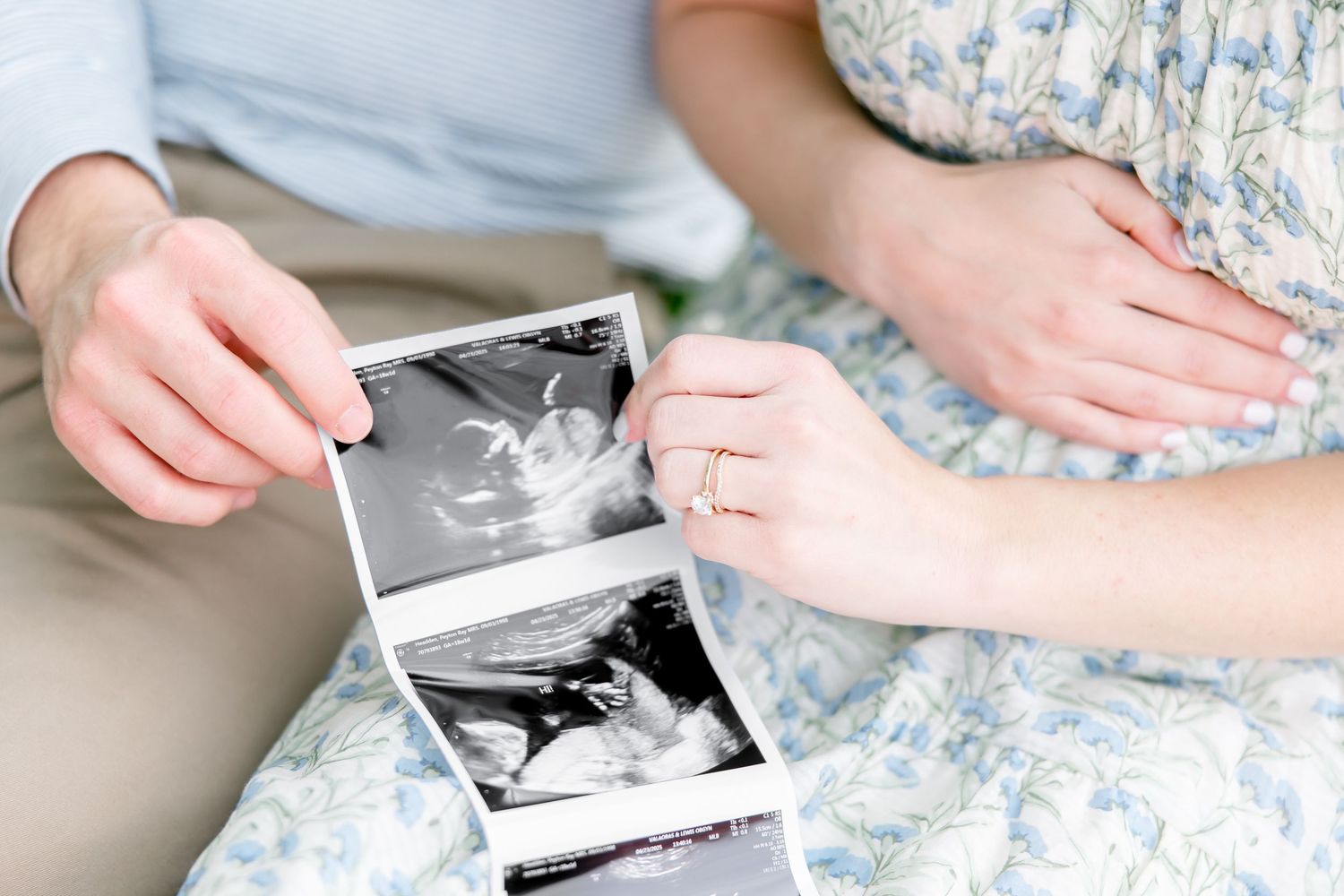 Close up view of hands holding black and white ultrasound scan photos while sitting on floral dress.