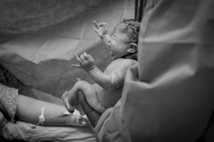 Birth Photography