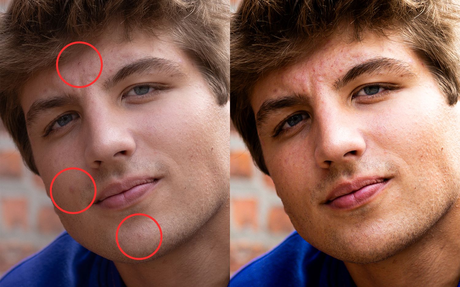 Before and after photo showing skin retouching and blemish removal.