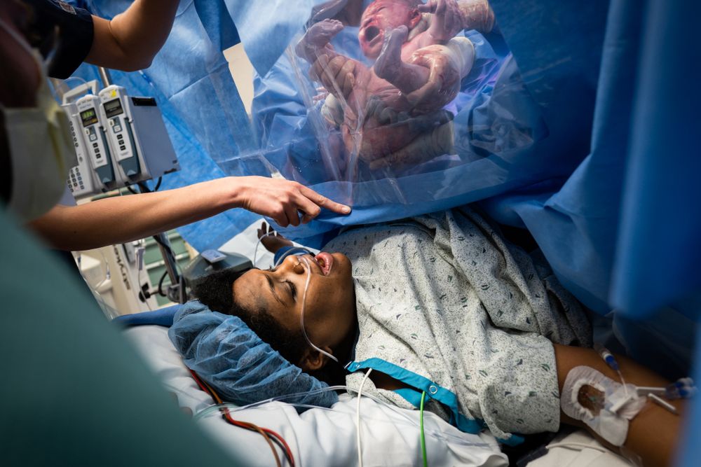 Mother seeing newborn baby for first time during C-section delivery in hospital.