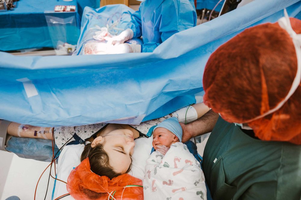Newborn baby placed on mothers chest during C-section delivery in bright operating room.
