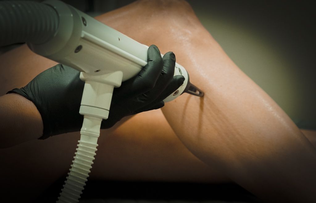 Technician in black gloves performing laser hair removal treatment on a clients leg.