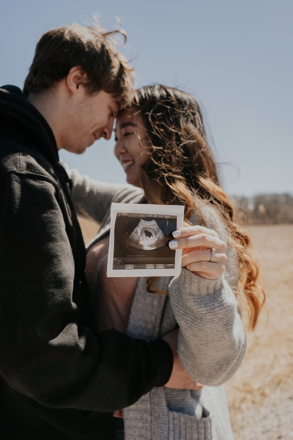 Couple sharing an intimate moment while holding up an ultrasound photo in a sunny field.