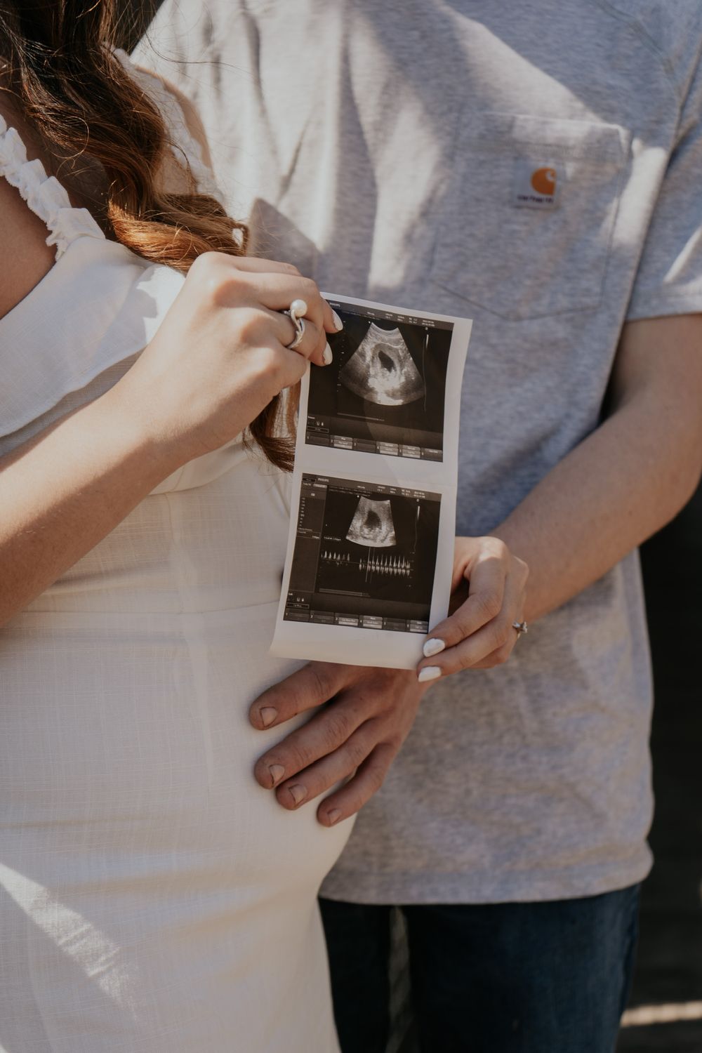 Close-up of hands holding ultrasound photos against light clothing.