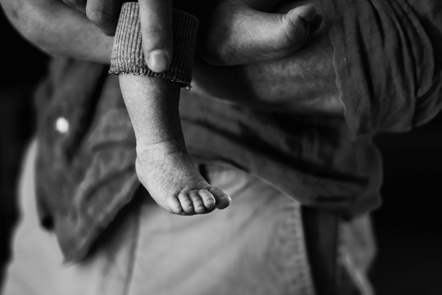 Black and white image of a scaly newborns foot dangling from daddy's arms.