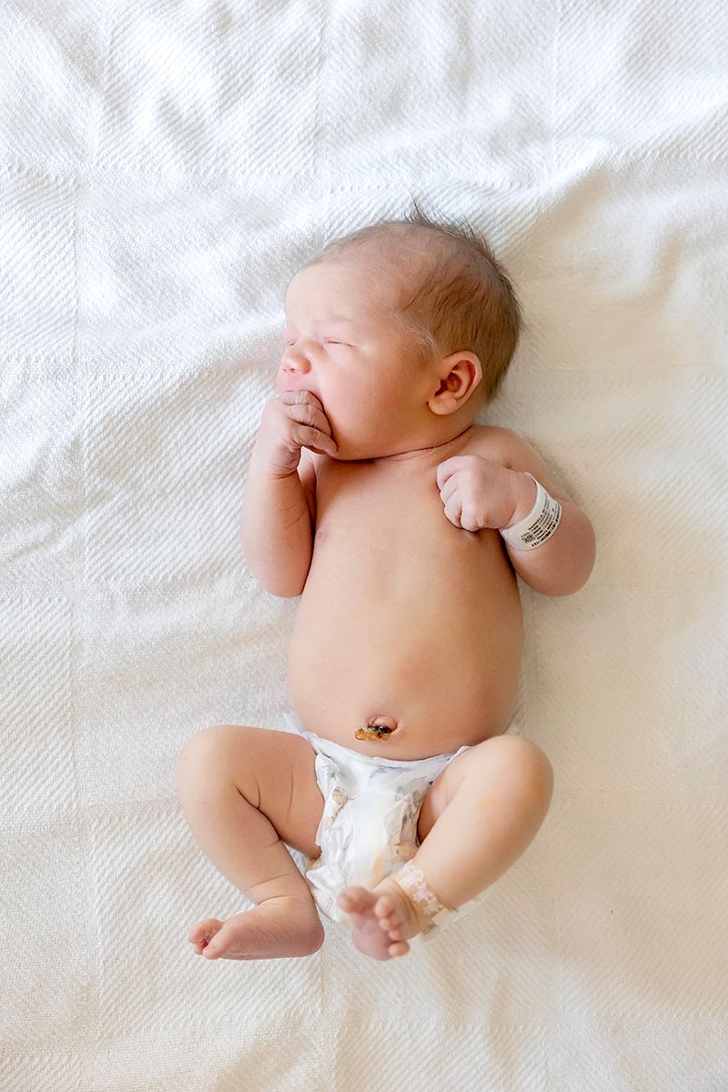 Newborn baby wearing a diaper lies peacefully on white bedding with hand near face and hospital bracelet on wrist.