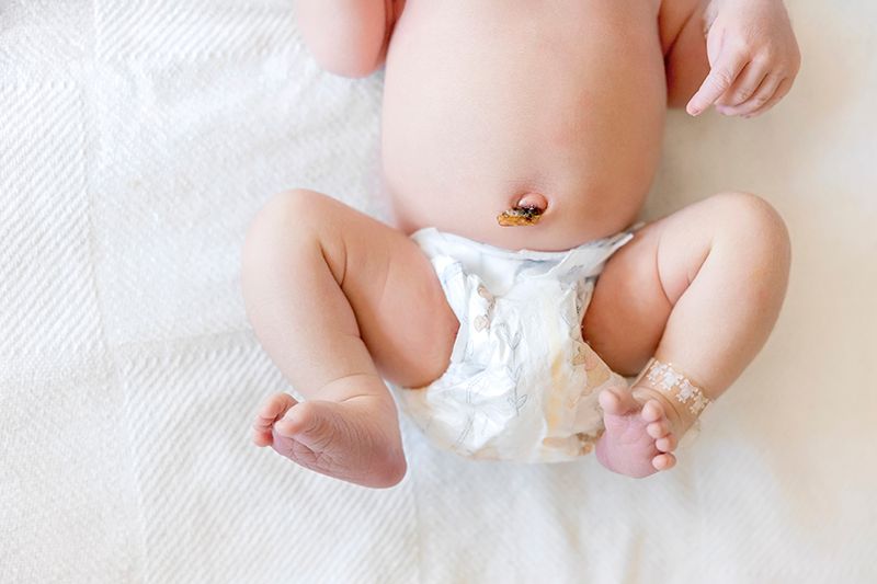 Baby wearing white diaper lying on white blanket with belly button visible.