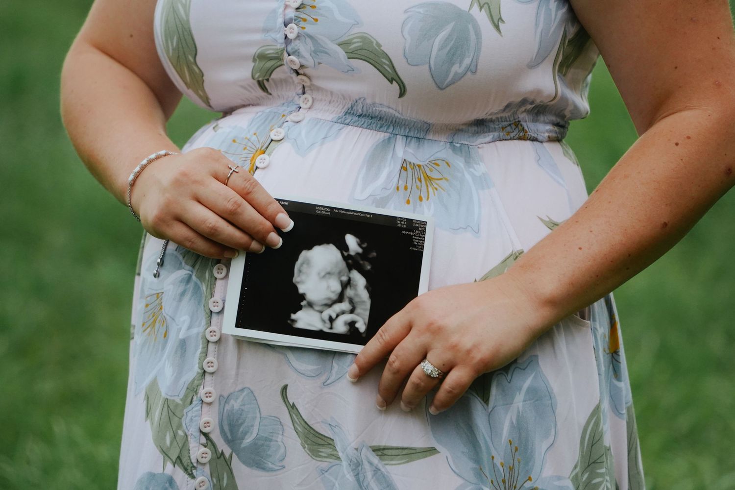 Pregnant woman in floral dress holding ultrasound photo against her baby bump outdoors.