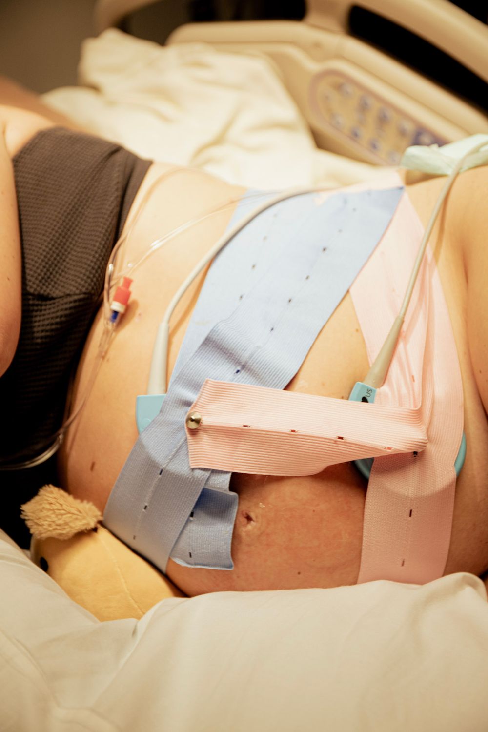 Medical monitoring equipment and sensors attached to patient during hospital care.