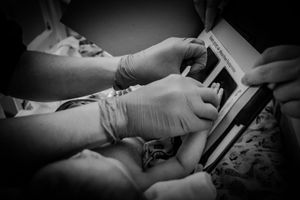 Medical procedure being performed with gloved hands shown in black and white.