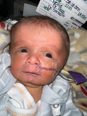 A newborn infant in white clothing with medical identification visible in the background.