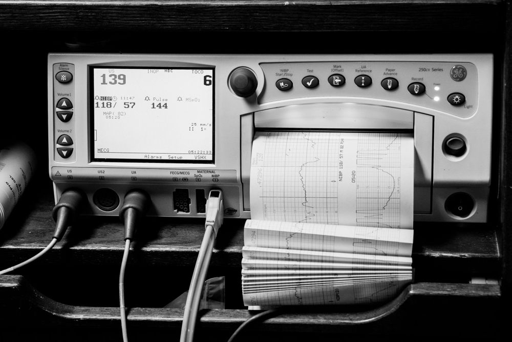 Medical monitoring device displays vital signs with data readout and paper chart printout in black and white.
