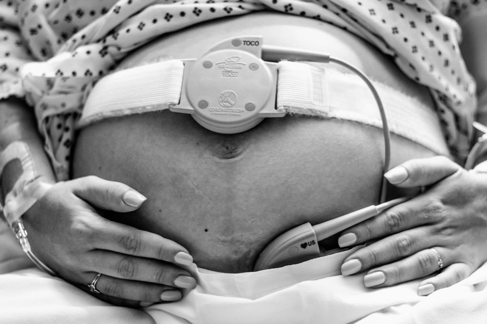 Black and white close up of pregnant belly with fetal heart rate monitor and hands gently placed around it.