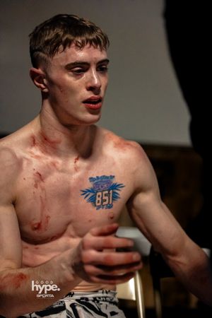 Shirtless fighter with bruises and a blue numbers tattoo on chest seen in dramatic lighting after a match.