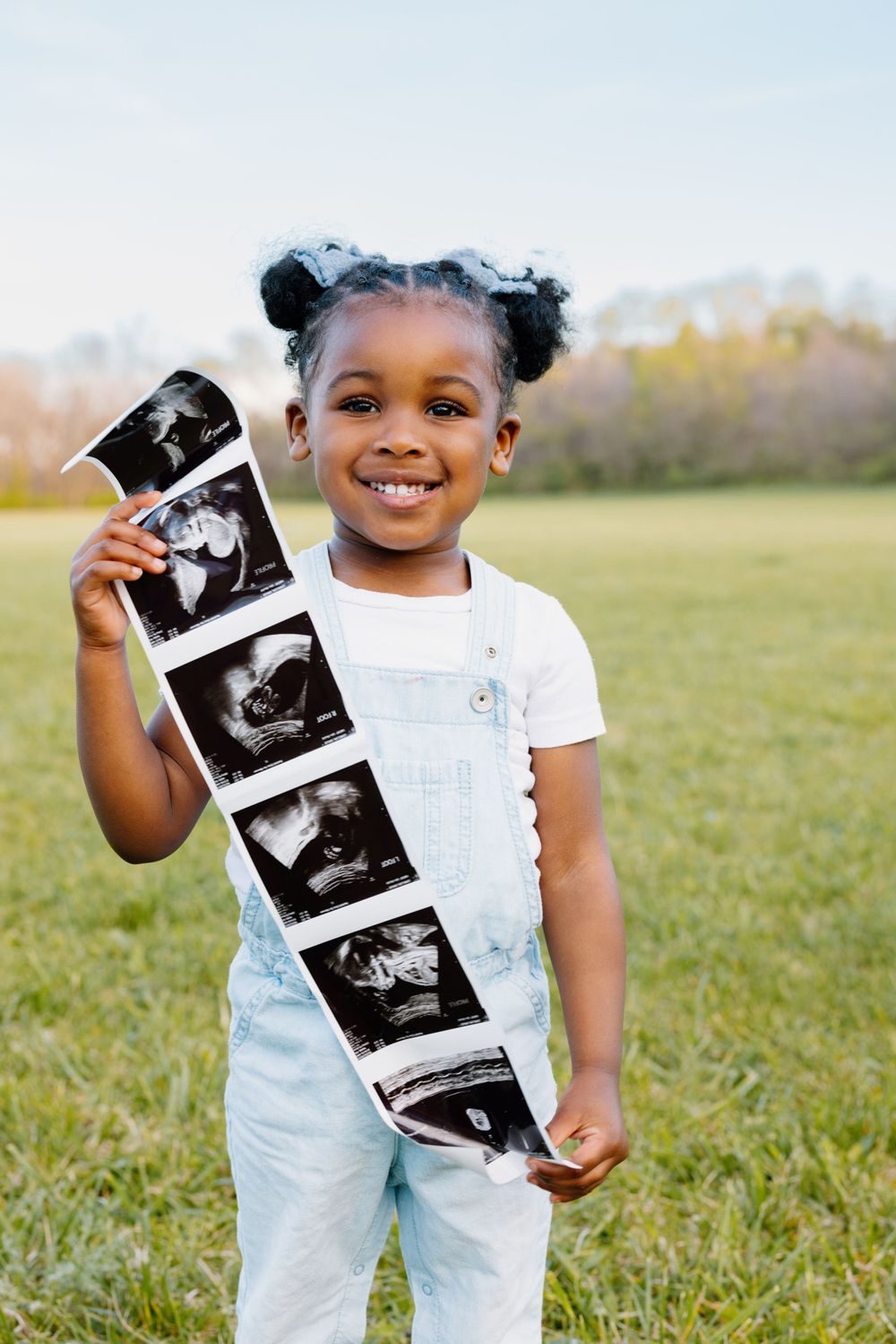 A young child in overalls smiles brightly while holding a strip of ultrasound images outdoors in a grassy field.