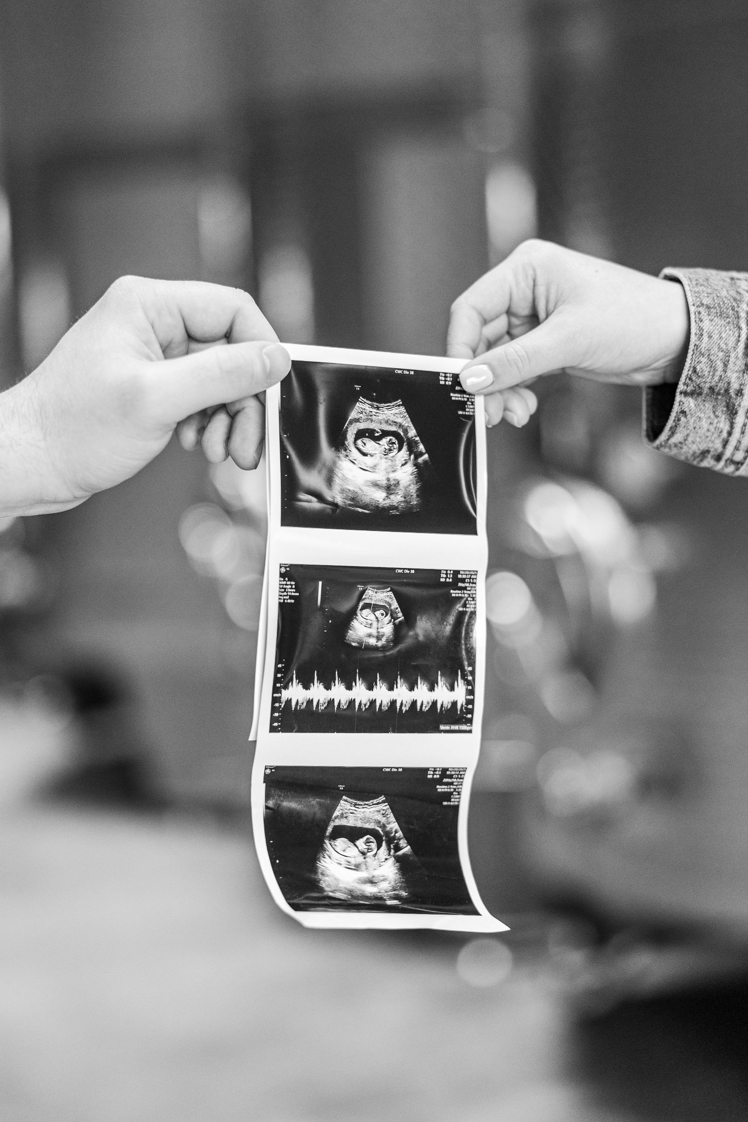 Two hands holding ultrasound sonogram strip showing baby images in black and white photography.