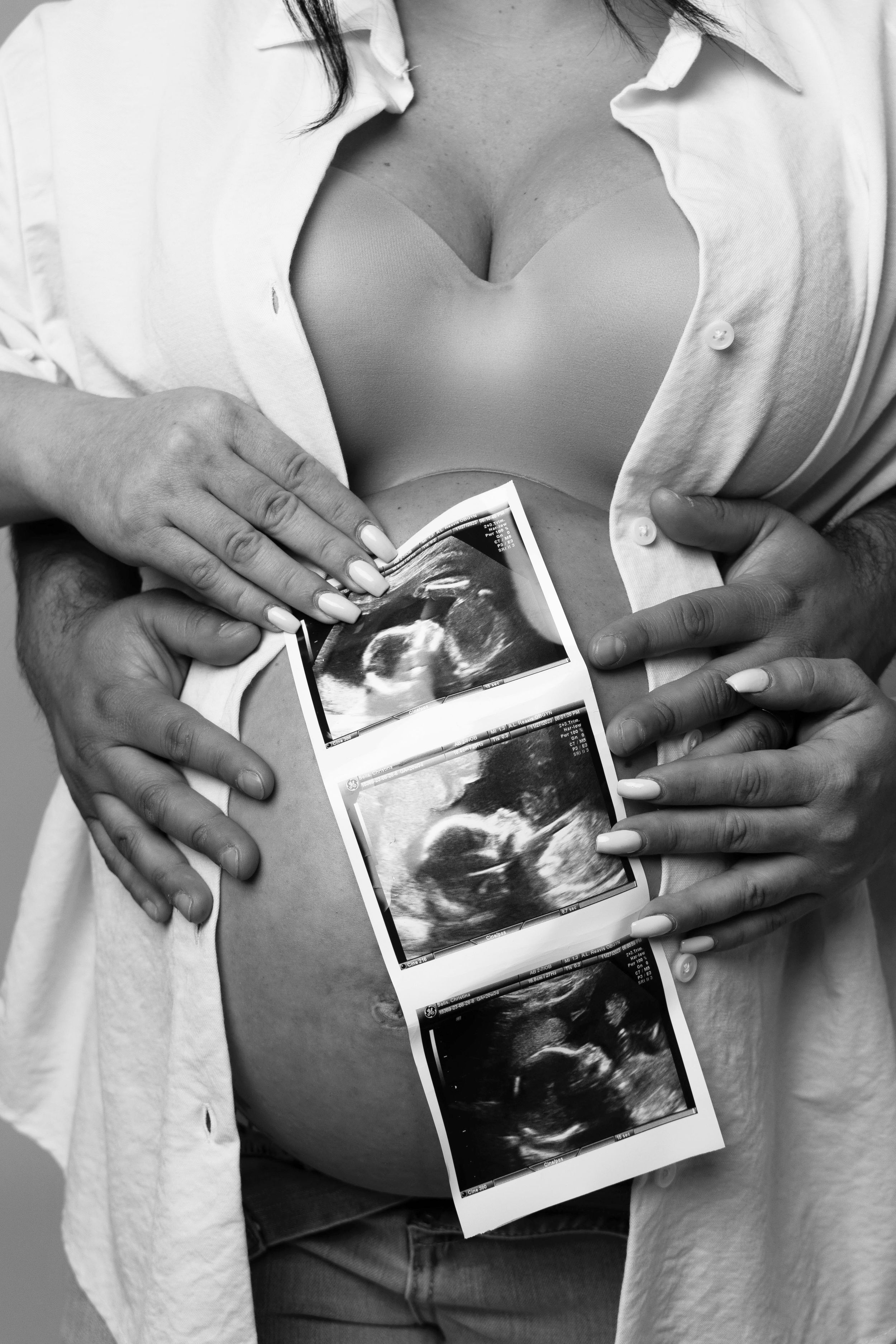 Black and white photo of ultrasound images held against pregnant belly in white shirt.