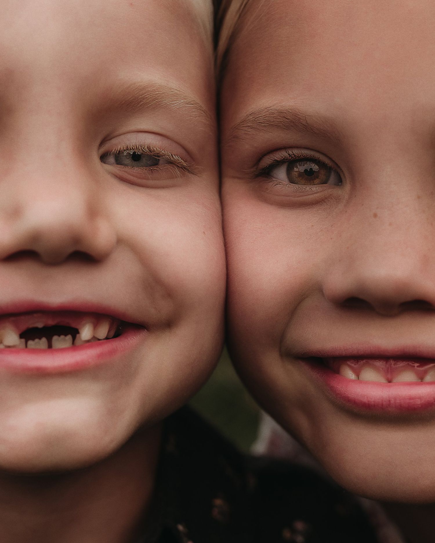 Close-up portrait showing bright smiles and missing teeth.