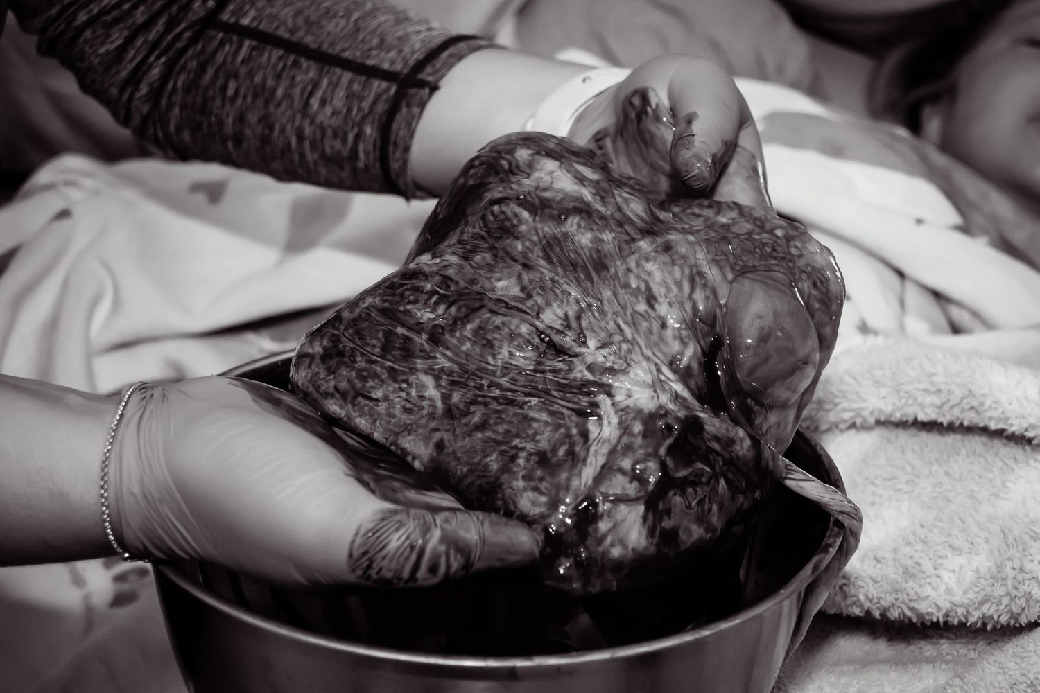 Black and white image of a midwife's hands holding a placenta.