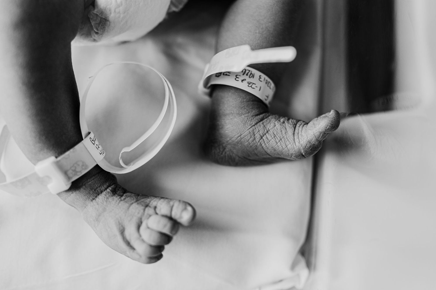 A close-up black and white image of medical equipment and tiny fingers.