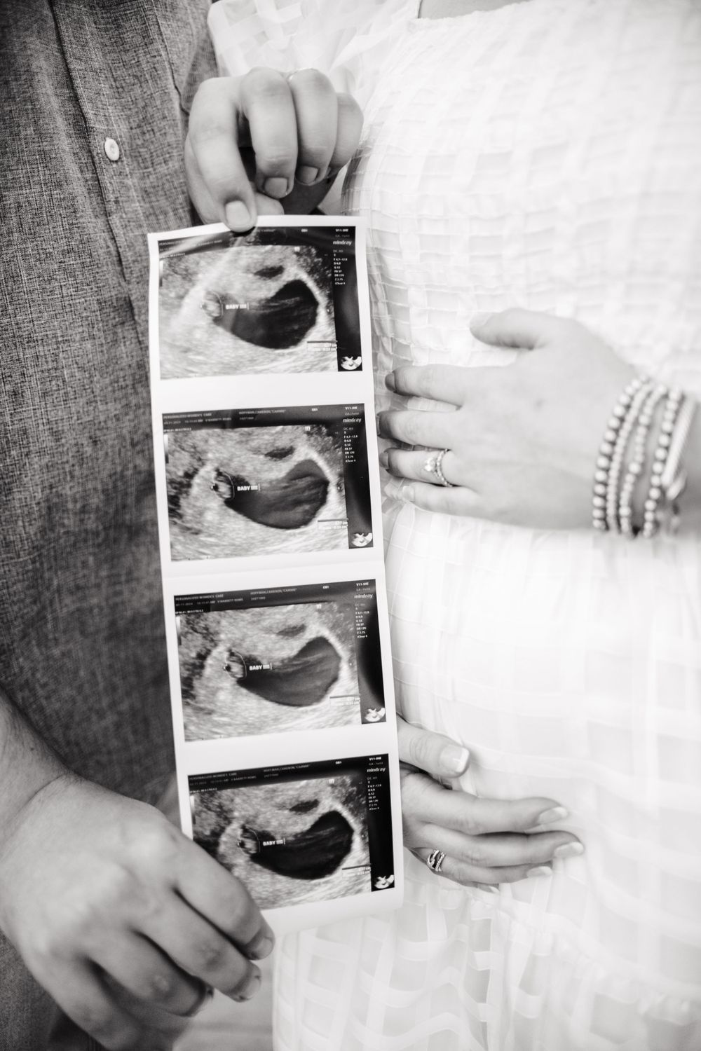 Black and white close-up shots of hands holding ultrasound images.