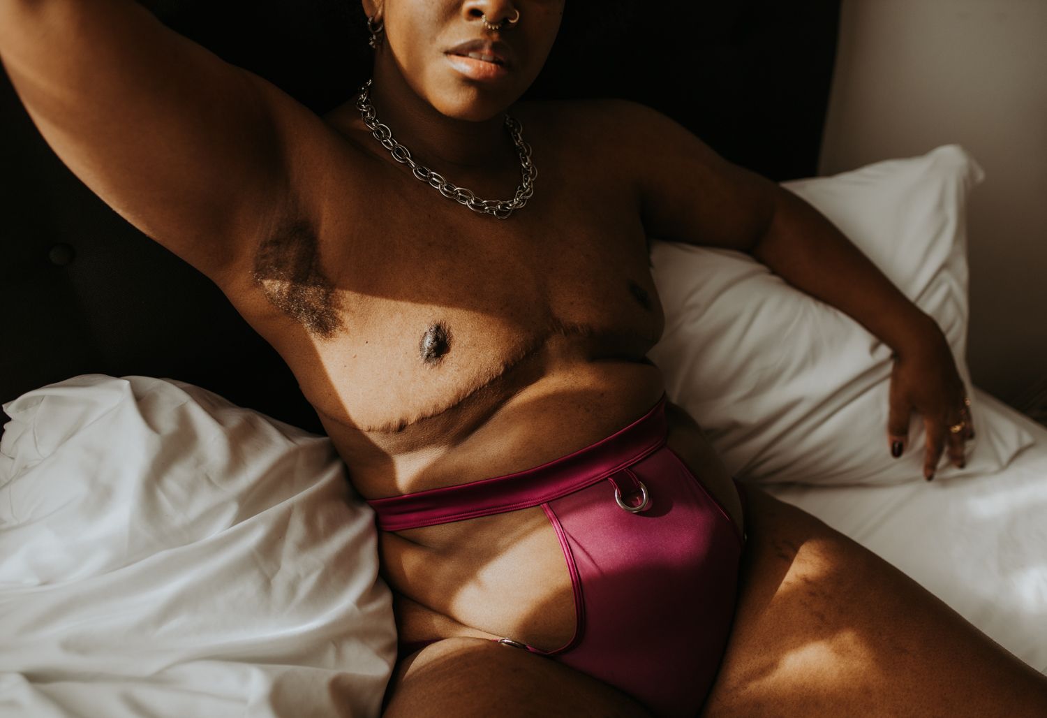 Intimate boudoir photography of a trans man in a sensual pose highlighting top surgery scars, white bedding and dramatic lighting/shadows.