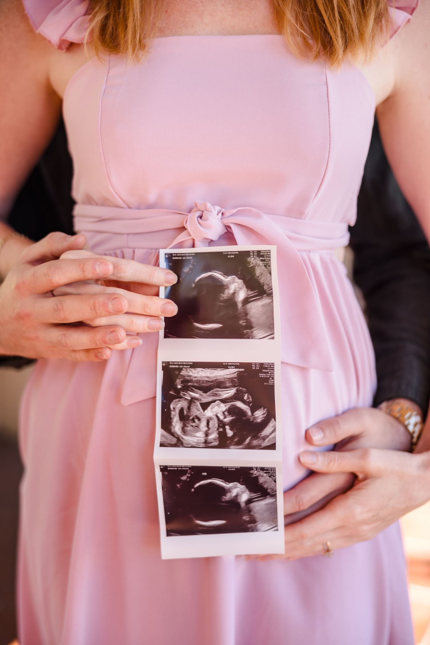 Someone in a pink dress holds ultrasound photos showing the development of their expected baby.
