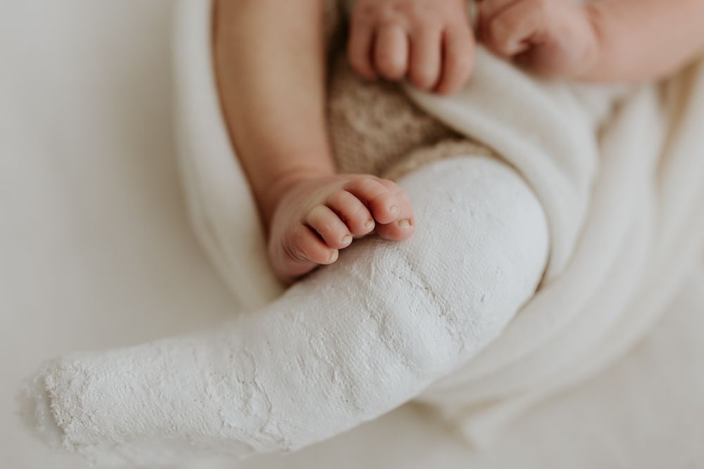 A baby's feet with one leg in a cast for his newborn photo session with Lauren Lunn Photography in her Adelaide studio.