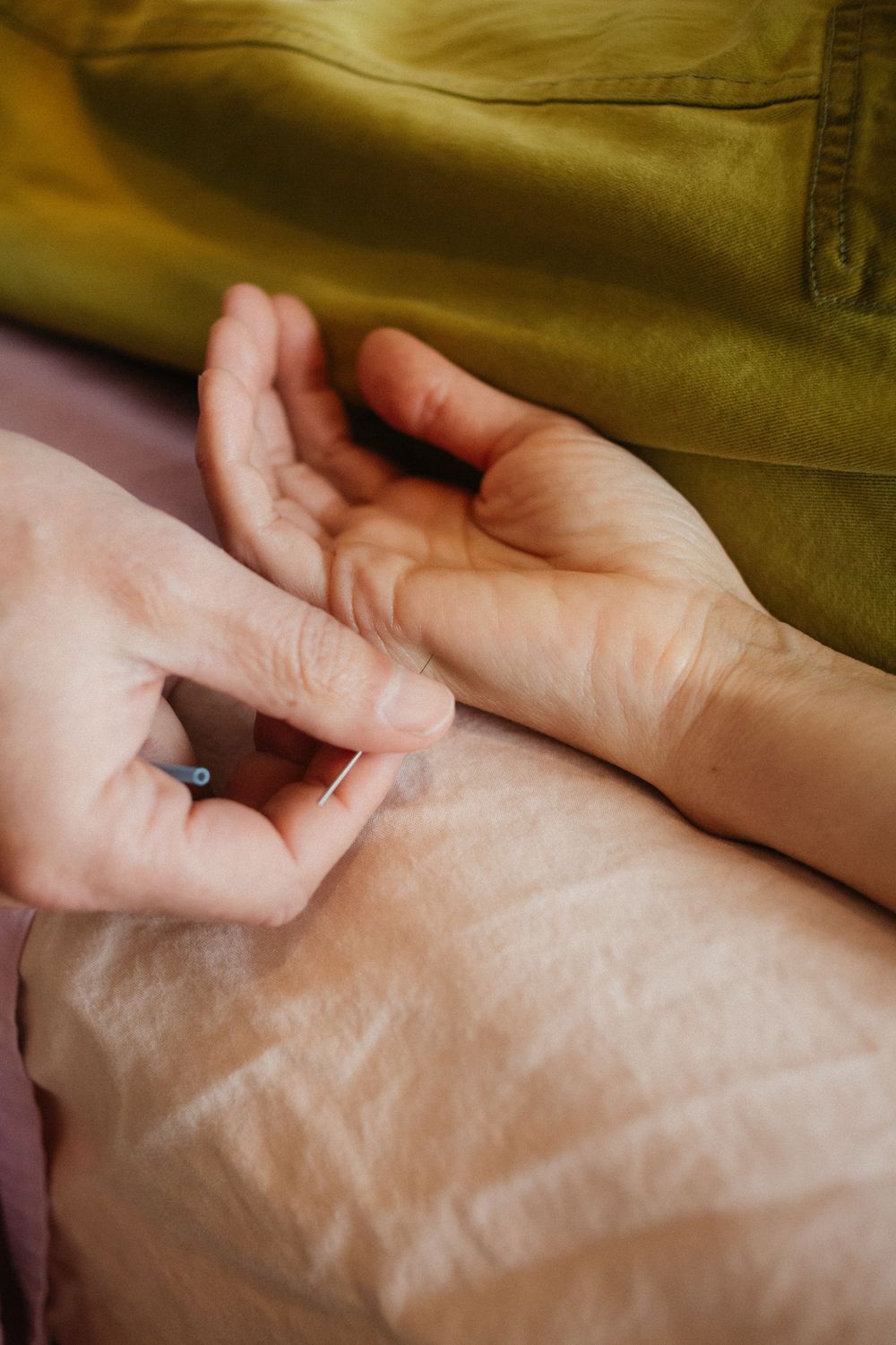Close up image of an acupuncturist inserting an acupuncture needle into the clients hand during a session at their studio in the West End.